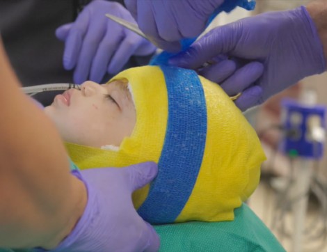 child getting head wrapped