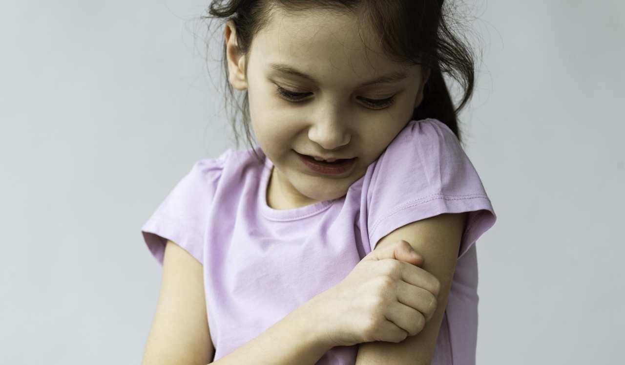 Child scratching arm