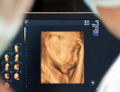 ultra sound picture